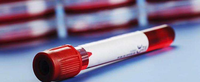 انعقاد خون انعقاد خون